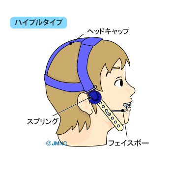 ヘッドギア ヘッドギア