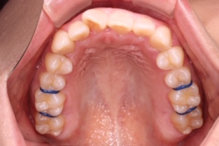 image1 image1
