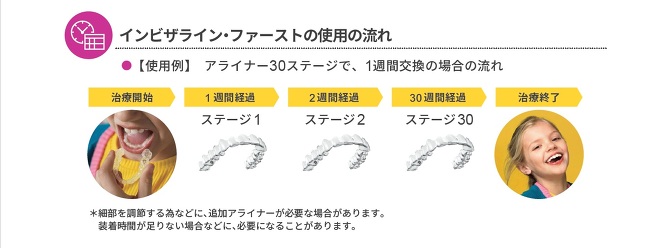 インビザライン・ファーストの治療の流れ