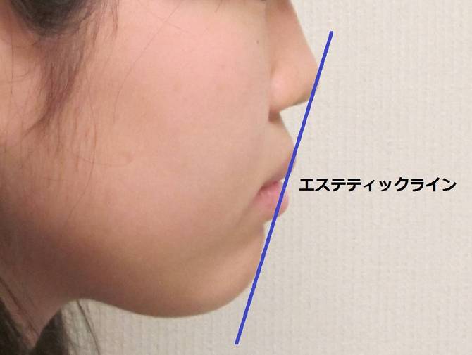 エステティックライン エステティックライン