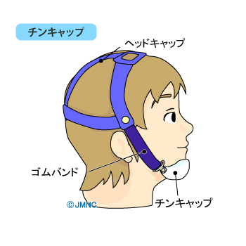 チンキャップ チンキャップ